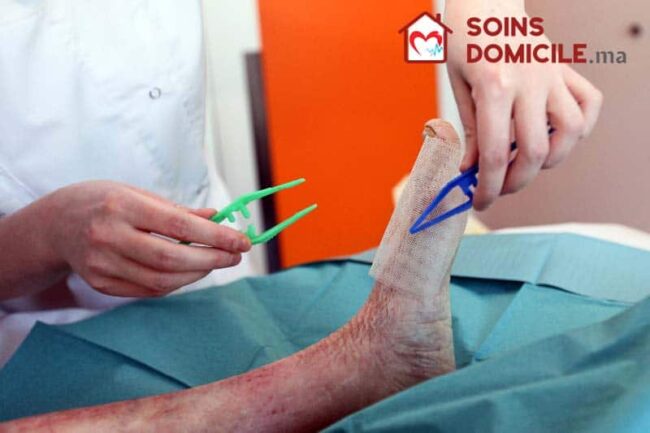Pansement stérile domicile Casablanca Pansement stérile domicile Casablanca