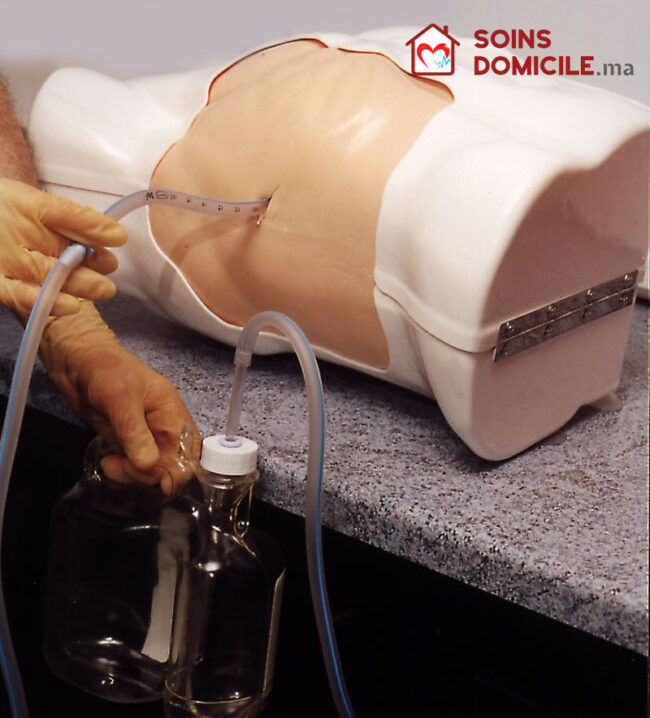 drain pleural drain pleural